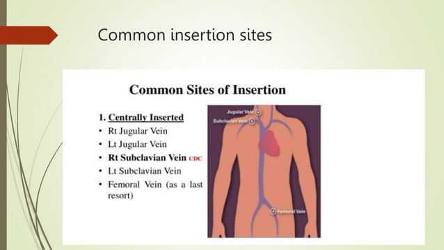 Central Line Indication Algorithm Central Venous Catheter Care - Central Line Associated Blood Stream ...