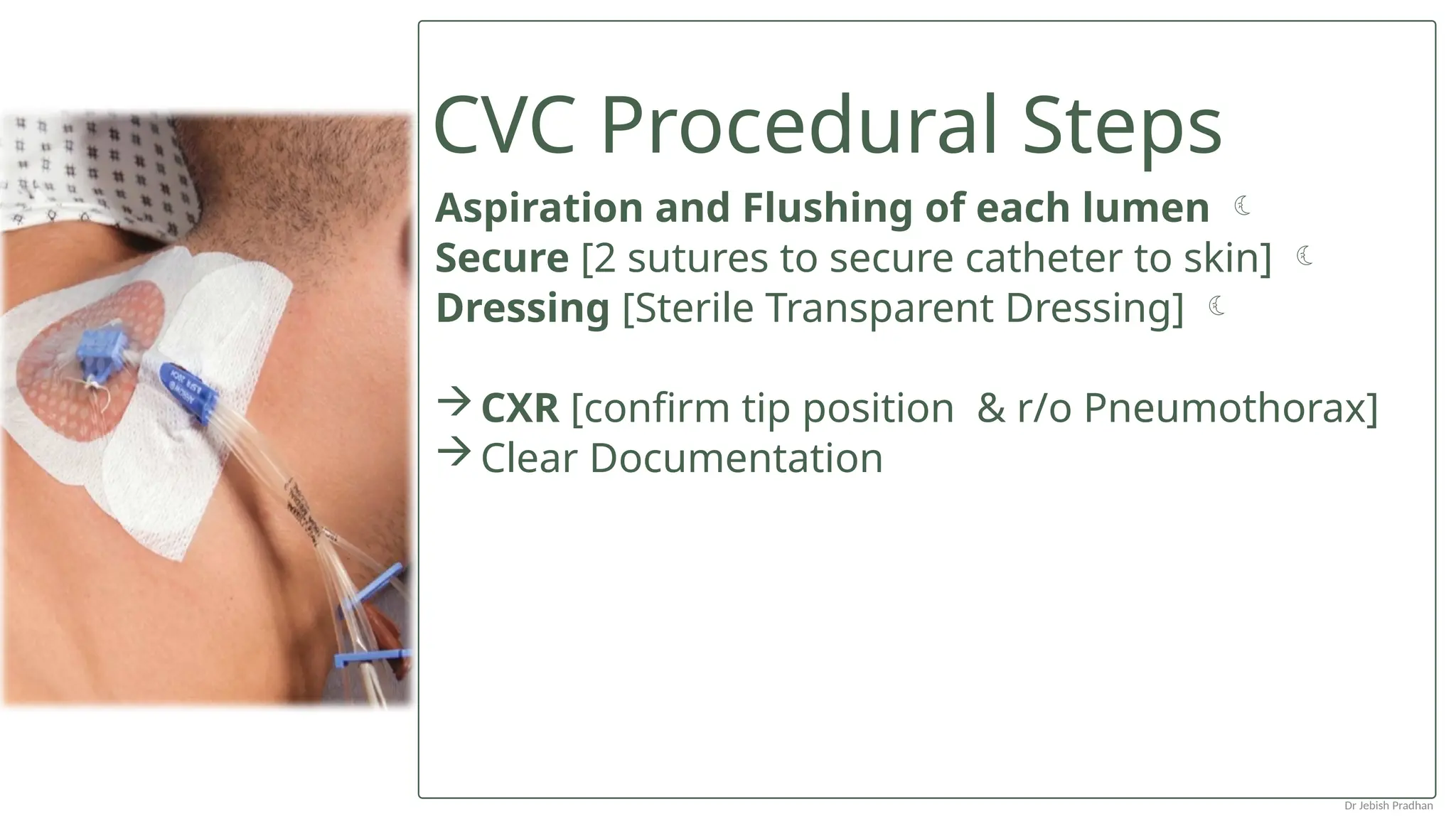 CVC Procedural Steps
Aspiration and Flushing of each lumen 
Secure [2 sutures to secure catheter to skin] 
Dressing [Sterile Transparent Dressing] 
CXR [confirm tip position & r/o Pneumothorax]
Clear Documentation
Dr Jebish Pradhan
 