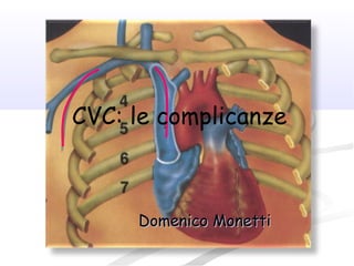 Domenico MonettiDomenico Monetti
CVC: le complicanze
 