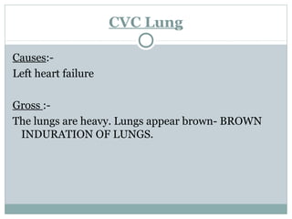 CVC Lung
Causes:-
Left heart failure
Gross :-
The lungs are heavy. Lungs appear brown- BROWN
INDURATION OF LUNGS.
 