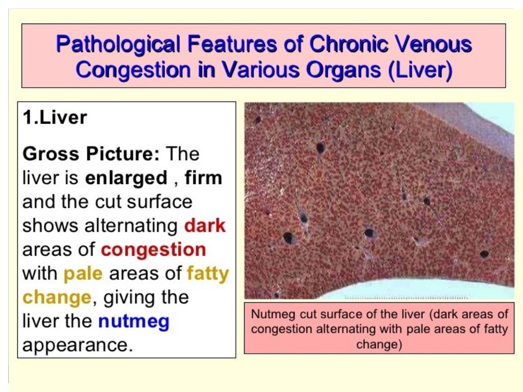 Cvc lung, liver and spleen
