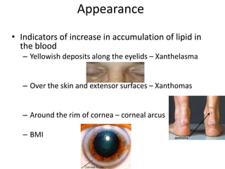 Cvd signs and symptoms | PPTX