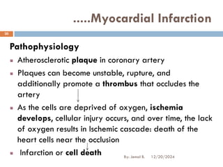 Pathophysiology
Atherosclerotic plaque in coronary artery
Plaques can become unstable, rupture, and
additionally promote a thrombus that occludes the
artery
As the cells are deprived of oxygen, ischemia
develops, cellular injury occurs, and over time, the lack
of oxygen results in Ischemic cascade: death of the
heart cells near the occlusion
Infarction or cell death
.....Myocardial Infarction
12/20/2024
20
By: Jemal B.
 