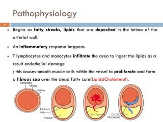 Pathophysiology
Begins as fatty streaks, lipids that are deposited in the intima of the
arterial wall.
An inflammatory response happens.
T lymphocytes and monocytes infiltrate the area to ingest the lipids as a
result endothelial damage
; this causes smooth muscle cells within the vessel to proliferate and form
a fibrous cap over the dead fatty core(Lipids(Cholesterol).
12/20/2024
4
By: Jemal B.
 