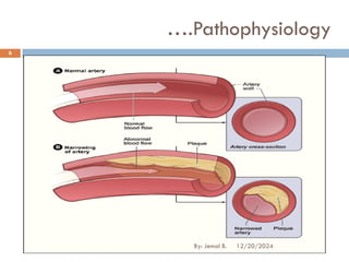 ….Pathophysiology
12/20/2024
6
By: Jemal B.
 