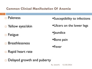 Common Clinical Manifestation Of Anemia
 Paleness
 Yellow eyes/skin
 Fatigue
 Breathlessness
 Rapid heart rate
 Delayed growth and puberty
12/20/2024
By: Jemal B.
89
▪Susceptibility to infections
▪Ulcers on the lower legs
▪Jaundice
▪Bone pain
▪Fever
 