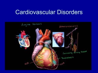 Cardiovascular Disorders
 