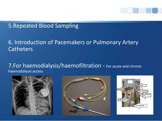 Central Venous Access | PPTX
