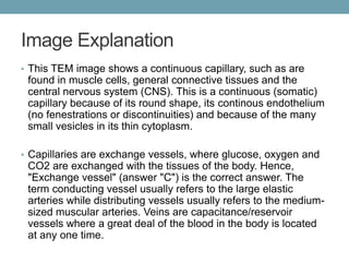 Image Explanation 
• This TEM image shows a continuous capillary, such as are 
found in muscle cells, general connective tissues and the 
central nervous system (CNS). This is a continuous (somatic) 
capillary because of its round shape, its continous endothelium 
(no fenestrations or discontinuities) and because of the many 
small vesicles in its thin cytoplasm. 
• Capillaries are exchange vessels, where glucose, oxygen and 
CO2 are exchanged with the tissues of the body. Hence, 
"Exchange vessel" (answer "C") is the correct answer. The 
term conducting vessel usually refers to the large elastic 
arteries while distributing vessels usually refers to the medium-sized 
muscular arteries. Veins are capacitance/reservoir 
vessels where a great deal of the blood in the body is located 
at any one time. 
 