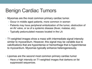Benign Cardiac Tumors 
• Myxomas are the most common primary cardiac tumor. 
• Occur in middle aged patients, more common in women 
• Patients may have peripheral embolization of the tumor, obstruction of 
an AV valve, or sx of a systemic disease (fever, malaise, etc). 
• Typically pedunculated masses located in the LA 
• T1-weighted images show a mass with intermediate signal intensity 
similar to myocardium. However, this signal may be variable due to 
calcifications that are hypointense or hemorrhage that is hyperintense 
to myocardium. Myxomas typically enhance heterogeneously. 
• Lipomas are the second most common primary cardiac tumor 
• Have a high intensity on T1-weighted images that darkens on fat 
suppressed sequences. 
 