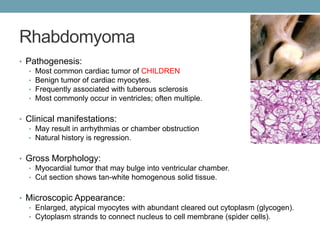 Rhabdomyoma 
• Pathogenesis: 
• Most common cardiac tumor of CHILDREN 
• Benign tumor of cardiac myocytes. 
• Frequently associated with tuberous sclerosis 
• Most commonly occur in ventricles; often multiple. 
• Clinical manifestations: 
• May result in arrhythmias or chamber obstruction 
• Natural history is regression. 
• Gross Morphology: 
• Myocardial tumor that may bulge into ventricular chamber. 
• Cut section shows tan-white homogenous solid tissue. 
• Microscopic Appearance: 
• Enlarged, atypical myocytes with abundant cleared out cytoplasm (glycogen). 
• Cytoplasm strands to connect nucleus to cell membrane (spider cells). 
 