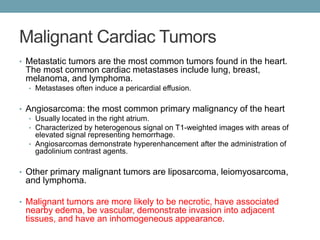 Malignant Cardiac Tumors 
• Metastatic tumors are the most common tumors found in the heart. 
The most common cardiac metastases include lung, breast, 
melanoma, and lymphoma. 
• Metastases often induce a pericardial effusion. 
• Angiosarcoma: the most common primary malignancy of the heart 
• Usually located in the right atrium. 
• Characterized by heterogenous signal on T1-weighted images with areas of 
elevated signal representing hemorrhage. 
• Angiosarcomas demonstrate hyperenhancement after the administration of 
gadolinium contrast agents. 
• Other primary malignant tumors are liposarcoma, leiomyosarcoma, 
and lymphoma. 
• Malignant tumors are more likely to be necrotic, have associated 
nearby edema, be vascular, demonstrate invasion into adjacent 
tissues, and have an inhomogeneous appearance. 
 