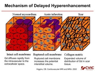 Mechanism of Delayed Hyperenhancement
Gd diffuses rapidly from
the intravascular to the
extracellular space.
Expanded volume of
distribution of Gd in scar
tissue.
Ruptured cell membrane
increases the potential
interstitial volume.
Higgins, CB. Cardiovascular MRI and MRA. 2002
 