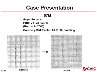 Case Presentation
• Asymptomatic
• ECG: V1~V3 poor R
(Normal in 2008)
• Coronary Risk Factor: HLP, HT, Smoking
67M
ID-67 6/25/2008 7/6/2009
 
