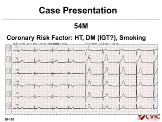 54M
Coronary Risk Factor: HT, DM (IGT?), Smoking
Case Presentation
ID-193
 