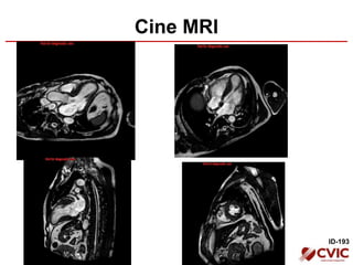 Cine MRI
ID-193
 