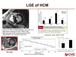 LGE of HCM
• LGE (+) in 50% of HCM patients. (Harris SR, et al.
Magn Reson Imaging Clin N Am. 2008;16:165)
• Most frequent in RV insertion points (73%)
(Rubinshtein R. Circ Heart Fail. 2010;3:51) （Adabag SA. JACC. 2008;51:1369）
Our case
Bruder O, et al. JACC.2010;56:875
Teraoka K, et al. MRI. 2004;22: 155
 