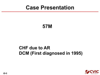 Case Presentation
57M
CHF due to AR
DCM (First diagnosed in 1995)
ID-5
 