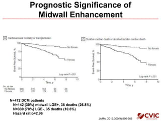 Prognostic Significance of
Midwall Enhancement
N=472 DCM patients
N=142 (30%) midwall LGE+, 38 deaths (26.8%)
N=330 (70%) LGE-, 35 deaths (10.6%)
Hazard ratio=2.96
JAMA. 2013;309(9):896-908
 