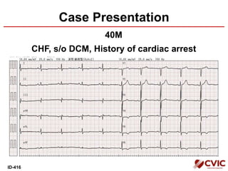 Case Presentation
40M
CHF, s/o DCM, History of cardiac arrest
ID-416
 