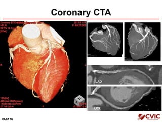 Coronary CTA
ID-6176
LAD
LCX
 