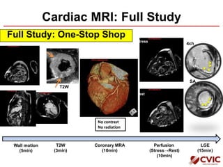 Cardiac MRI: Full Study
Full Study: One-Stop Shop
Wall motion
(5min)
Perfusion
(Stress→Rest)
(10min)
Stress
Rest
LGE
(15min)
Coronary MRA
(10min)
4ch
SA
No contrast
No radiation
T2W
(3min)
T2W
 