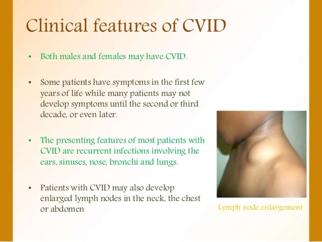 COMMON VARIABLE IMMUNODEFICIENCY (CVID) COMMON VARIABLE IMMUNODEFICIENCY (CVID)