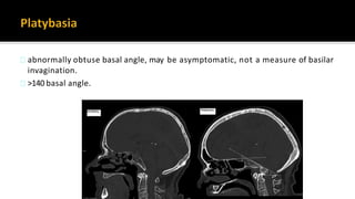 Cranio vertebral junction anomalies | PPTX