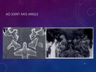 AO JOINT AXIS ANGLE
26
 