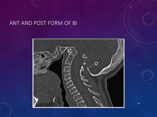 ANT AND POST FORM OF BI
34
 