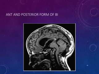 ANT AND POSTERIOR FORM OF BI
35
 