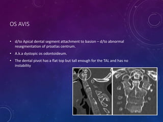 OS AVIS
• d/to Apical dental segment attachment to basion – d/to abnormal
resegmentation of proatlas centrum.
• A.k.a dystopic os odontoideum.
• The dental pivot has a flat top but tall enough for the TAL and has no
instability
48
 
