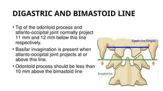 Comprehensive Overview of Craniovertebral Junction Anatomy and ...
