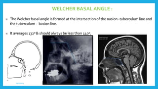 CRANIO VERTEBRAL JUNCTION RADIOLOGICAL ANATOMY .pptx