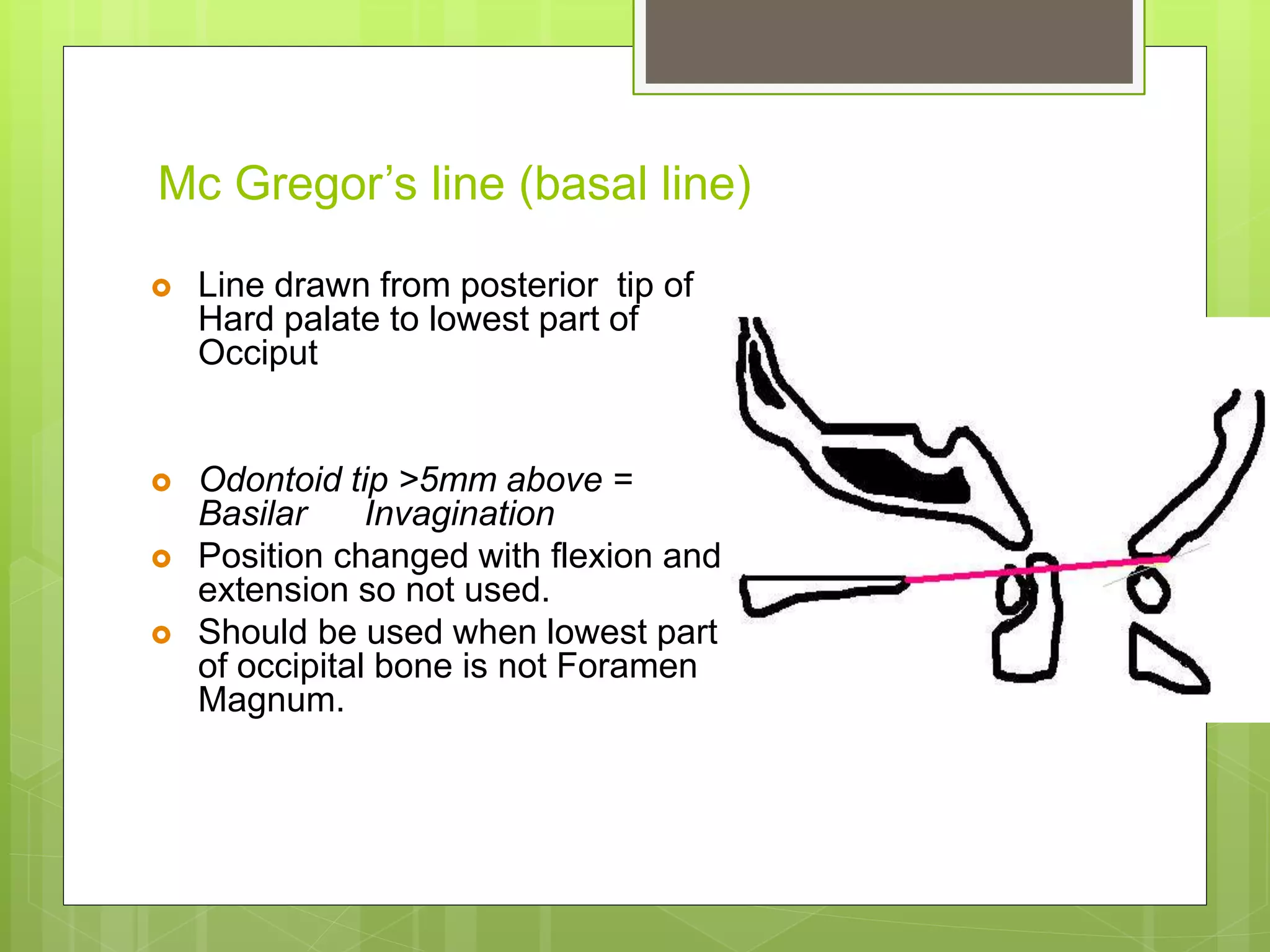 Mc Gregor’s line (basal line)
 Line drawn from posterior tip of
Hard palate to lowest part of
Occiput
 Odontoid tip >5mm above =
Basilar Invagination
 Position changed with flexion and
extension so not used.
 Should be used when lowest part
of occipital bone is not Foramen
Magnum.
 