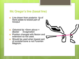 Mc Gregor’s line (basal line)
 Line drawn from posterior tip of
Hard palate to lowest part of
Occiput
 Odontoid tip >5mm above =
Basilar Invagination
 Position changed with flexion and
extension so not used.
 Should be used when lowest part
of occipital bone is not Foramen
Magnum.
 