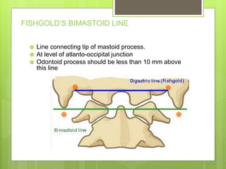 FISHGOLD’S BIMASTOID LINE
 Line connecting tip of mastoid process.
 At level of atlanto-occipital junction
 Odontoid process should be less than 10 mm above
this line
 