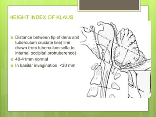 HEIGHT INDEX OF KLAUS
 Distance between tip of dens and
tuberculum cruciate line( line
drawn from tuberculum sella to
internal occipital protruberence)
 40-41mm normal
 In basilar invagination <30 mm
 