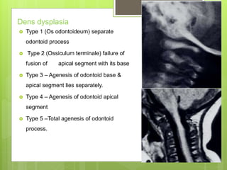 Dens dysplasia
 Type 1 (Os odontoideum) separate
odontoid process
 Type 2 (Ossiculum terminale) failure of
fusion of apical segment with its base
 Type 3 – Agenesis of odontoid base &
apical segment lies separately.
 Type 4 – Agenesis of odontoid apical
segment
 Type 5 –Total agenesis of odontoid
process.
 