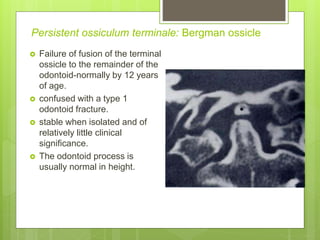 Persistent ossiculum terminale: Bergman ossicle
 Failure of fusion of the terminal
ossicle to the remainder of the
odontoid-normally by 12 years
of age.
 confused with a type 1
odontoid fracture.
 stable when isolated and of
relatively little clinical
significance.
 The odontoid process is
usually normal in height.
 