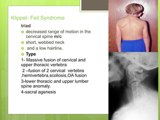 Klippel- Feil Syndrome
triad
 decreased range of motion in the
cervical spine m/c
 short, webbed neck
 and a low hairline.
 Type
1- Massive fusion of cervical and
upper thoracic vertebra
2 –fusion of 2 cervical vertebra
,hemivertebra,scoliosis,OA fusion
3-lower thoracic and upper lumber
spine anomaly.
4-sacral agenesis
 