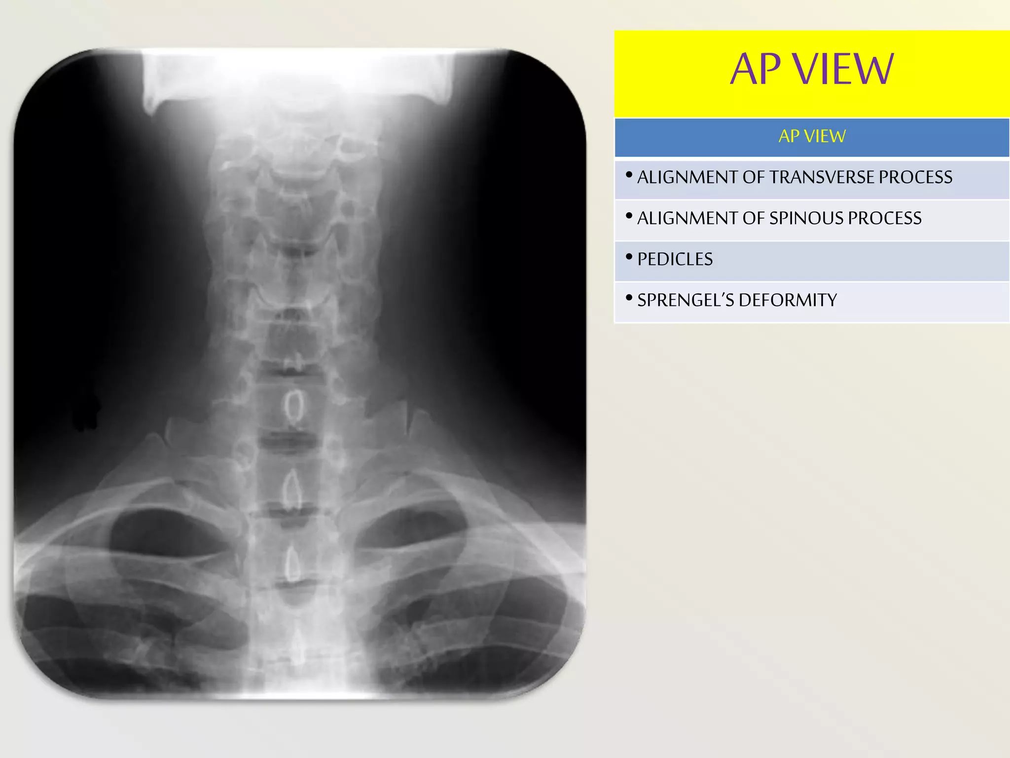 cvj radiology BY DR GAURAV CHAUHAN | PPTX
