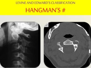 cvj radiology BY DR GAURAV CHAUHAN | PPTX