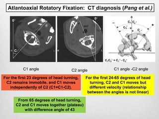 Instability of the cranio-vertebral junction (CVJ) | PPTX