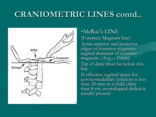 CRANIOMETRIC LINES contd.. <ul><li>McRae’s LINE </li></ul><ul><li>(Foramen Magnum line)- </li></ul><ul><li>Joins anterior ...
