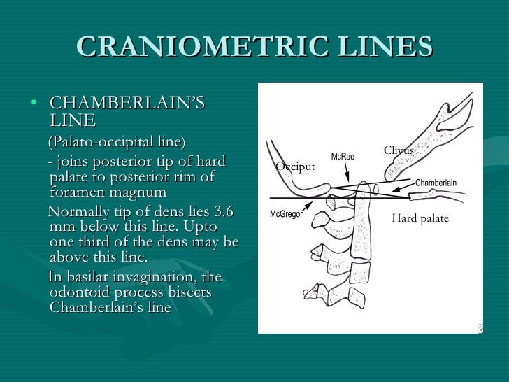 Chamberlain Line Radiology , Chamberlain’s line [Neurosurgery Wiki ...