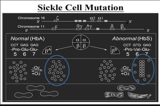 BỆNH HEMOGLOBIN
• BỆNH HỒNG CẦU HÌNH LiỀM: HbS
– 2 CHUỖI ALPHA BÌNH THƯỜNG
– 2 CHUỖI BÊTA ĐỘT BiẾN
• BỆNH HỒNG CẦU HÌNH BIA: HbC (Glu6Lys)
• BỆNH THALASSEMIA
 