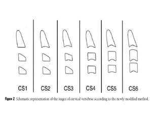 Cvm method | PPT