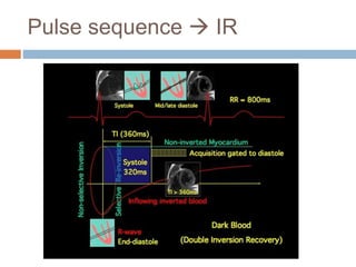 Cardiac MRI principle | PPTX