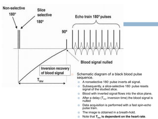 Cardiac MRI principle | PPTX